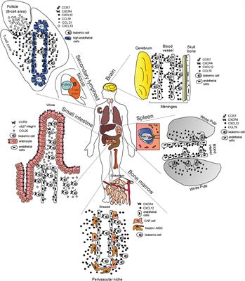 Chemotactic Cues for NOTCH1-Dependent Leukemia